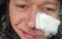 Лидер группы "Бумбокс" Андрей Хлывнюк ранен
