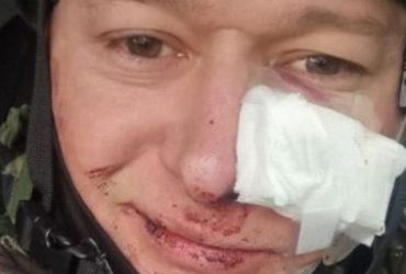 Лидер группы Бумбокс Андрей Хлывнюк ранен