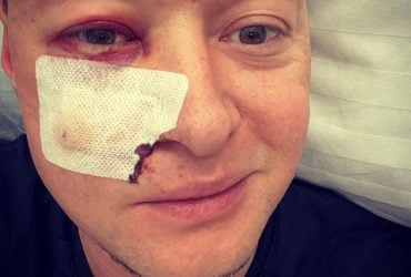 Лідер Бумбоксу Хливнюк потрапив до лікарні після обстрілу (фото)