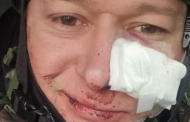Лидер группы "Бумбокс" Андрей Хлывнюк ранен
