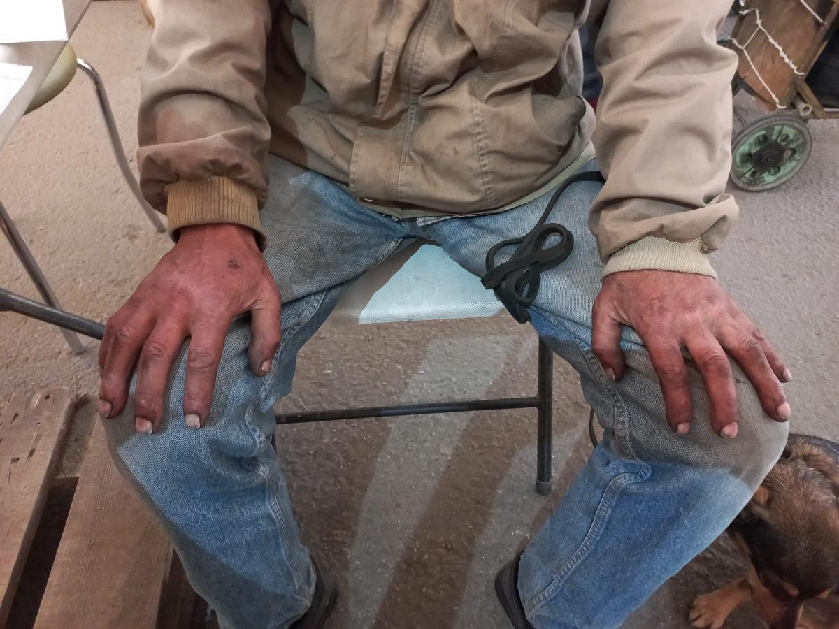 Руки сбежавшего из окруженного Мариуполя мужчины / фото Галина Однорог