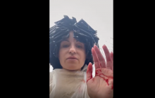 Краса врятує життя: одеситку від осколків ракети вберегла шапочка з фольги (відео)