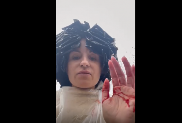 Краса врятує життя: одеситку від осколків ракети вберегла шапочка з фольги (відео)