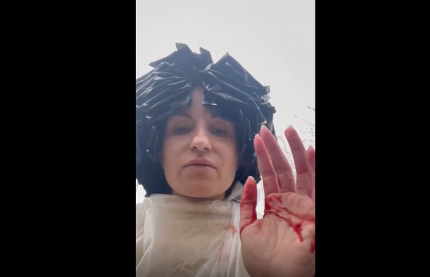 Краса врятує життя: одеситку від осколків ракети вберегла шапочка з фольги (відео)