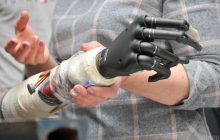 Українських військових будуть лікувати й протезувати за кордон – Мінветеранів