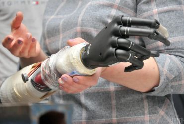 Українських військових будуть лікувати й протезувати за кордон – Мінветеранів