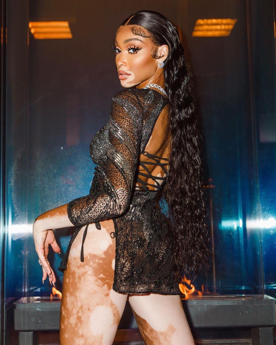 Вінні Харлоу / instagram.com/winnieharlow Вінні Харлоу / instagram.com/winnieharlow