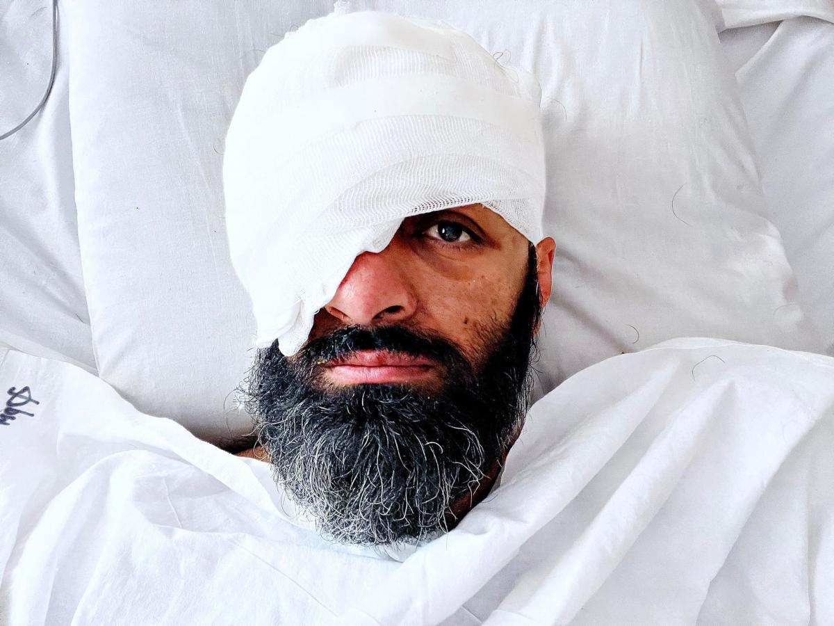 Маси Найем показал, как выглядит после ранения / фото Facebook/Маси Найем