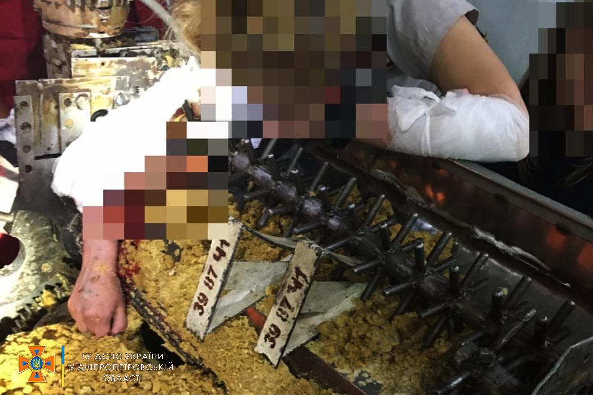 В Днепре женщина едва не потеряла руку / фото dp.dsns.gov.ua В Днепре женщина едва не потеряла руку / фото dp.dsns.gov.ua