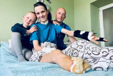 Женщина из Лимана в результате обстрела оккупантов потеряла ребенка, руку и ногу (фото)