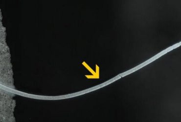 Найдена самая крупная бактерия: длиной с ресницу и непохожая на другие (фото)