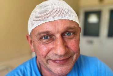 Гігантська пухлина завадила українцеві поїхати на фронт: її видалили у Львові