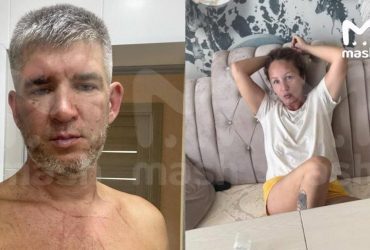 Поддерживал войну: в Крыму женщина избила мужа сковородкой