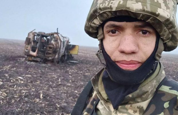 Известный актер показал, как выглядит после тяжелого ранения на фронте