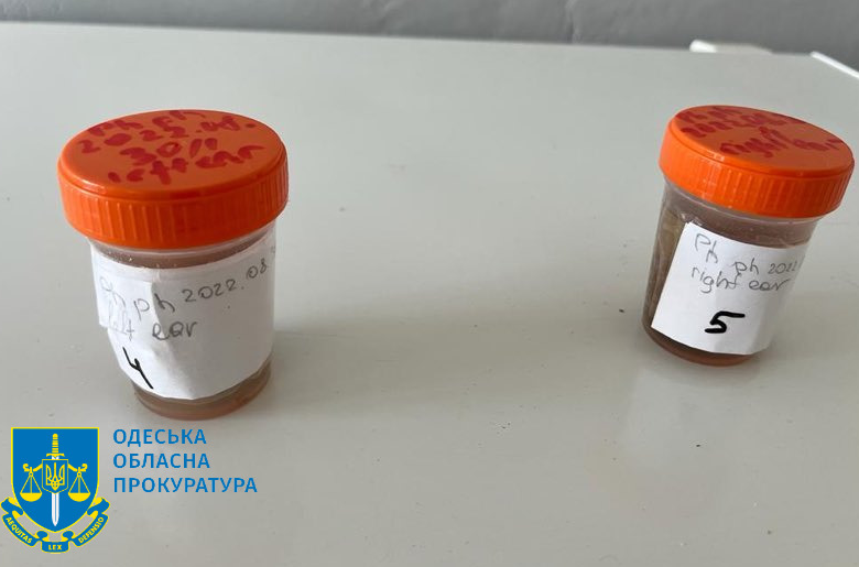 Названо можливу причину масової загибелі дельфінів в Одеській області / фото od.gp.gov.ua Названо можливу причину масової загибелі дельфінів в Одеській області / фото od.gp.gov.ua