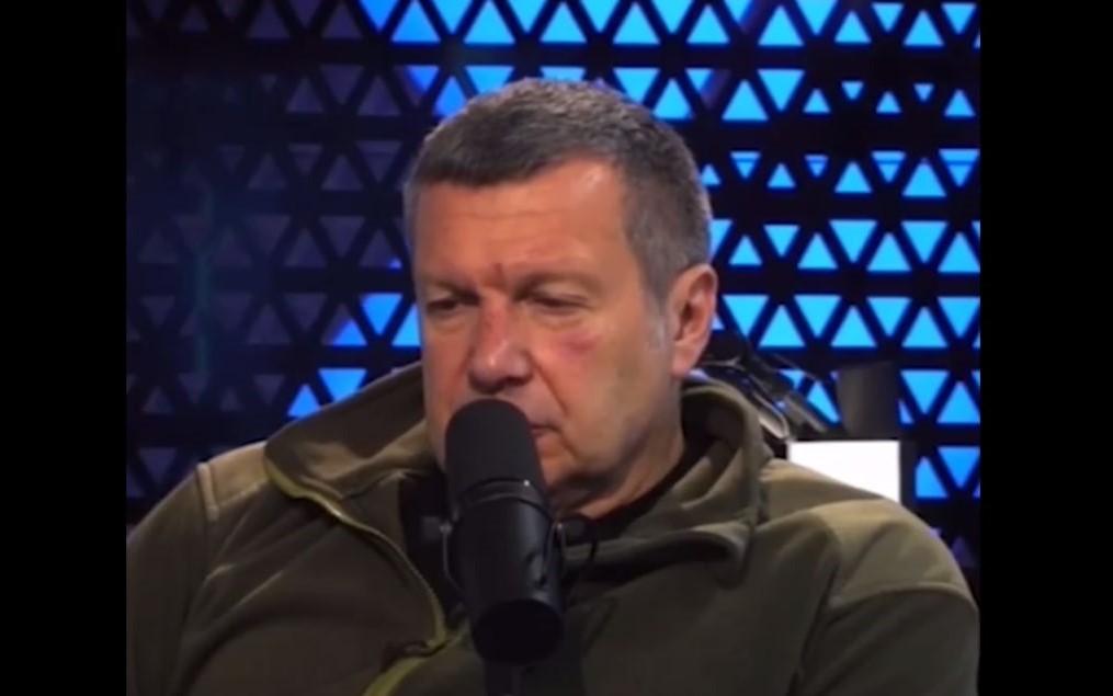 Соловьев "засветил" синяки / скриншот Соловьев "засветил" синяки / скриншот