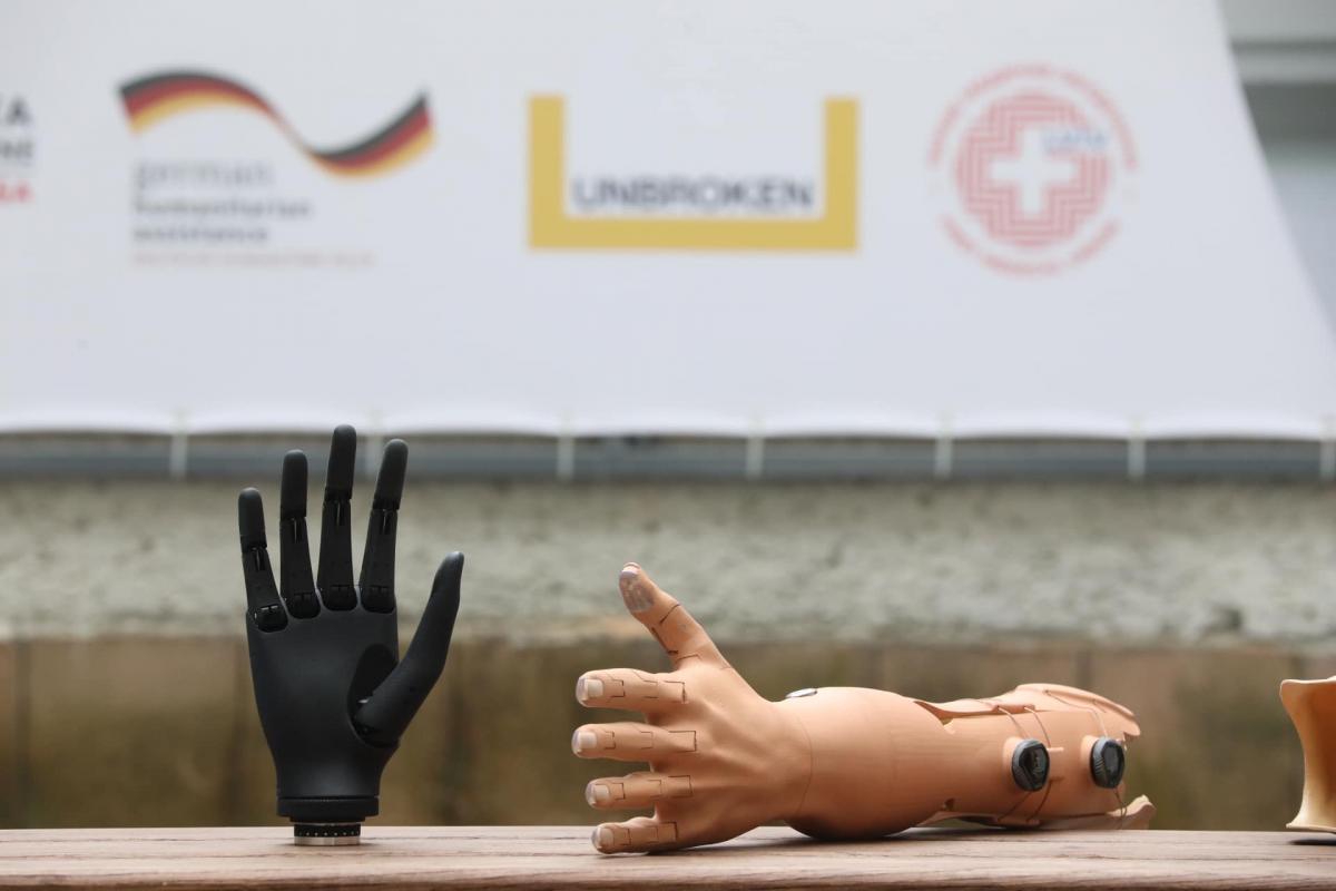 Біонічний протез та протез, надрукований на 3D-принтері / фото Перше територіальне медичне об'єднання Львова Біонічний протез та протез, надрукований на 3D-принтері / фото Перше територіальне медичне об'єднання Львова