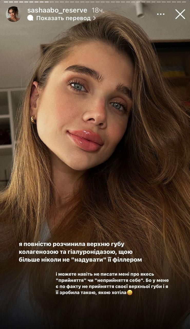 Саша Бо сделала операцию на губы / скриншот Саша Бо сделала операцию на губы / скриншот