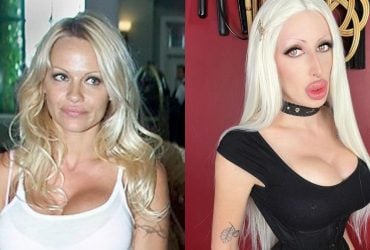 Фанатка Памелы Андерсон шокировала результатом пластики: похожа на трансгендера (фото)