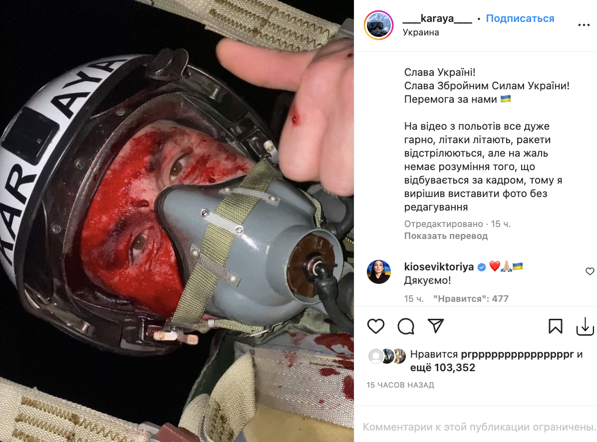 Отведший истребитель от Винницы пилот Karaya показал окровавленное лицо (фото) Отведший истребитель от Винницы пилот Karaya показал окровавленное лицо (фото)