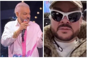 Кіркоров зробив пластичну операцію і назвав це неземною красою (відео)