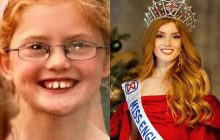 Из гадкого утенка в красавицу: над этой девушкой раньше смеялись, сегодня - восхищаются