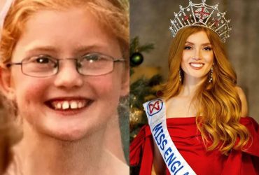 З гидкого каченяти в красуню: над цією дівчиною раніше сміялися, сьогодні - захоплюються