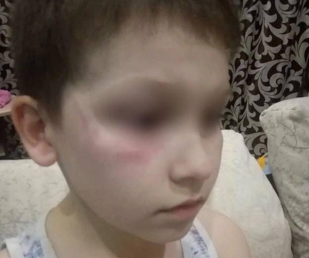В РФ ребенка избили за сине-желтые санки / База