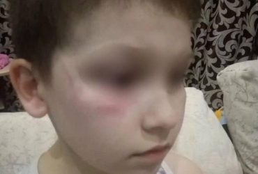 Назвали українцем і поставили фінгал: в РФ дитину побили за синьо-жовті санки (фото)