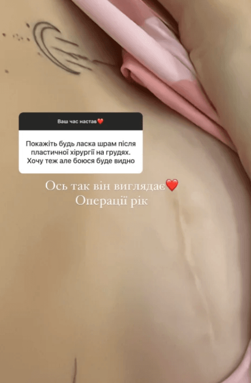 Тринчер увеличила грудь / скриншот Тринчер увеличила грудь / скриншот