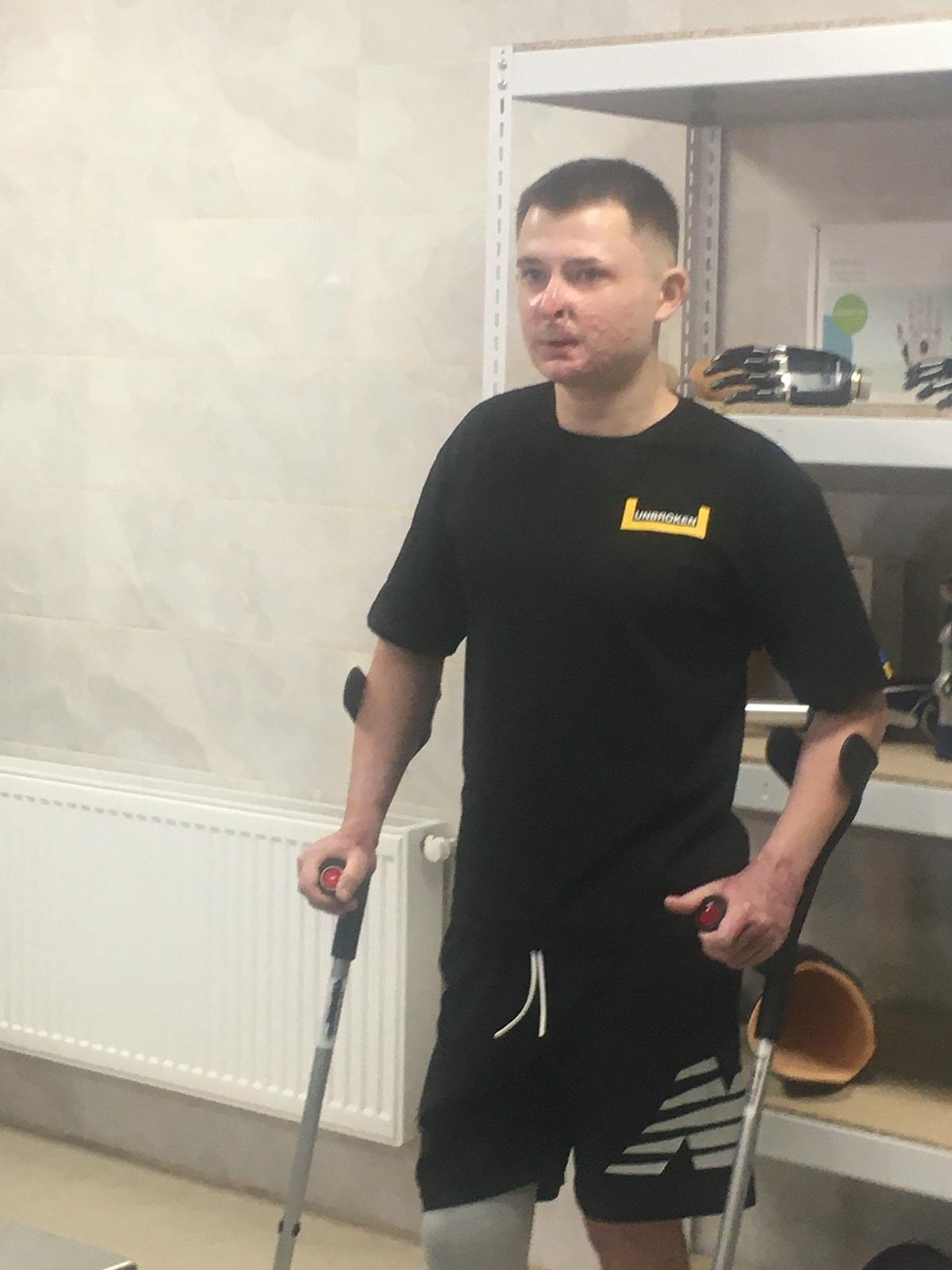 Ілля чекає на свій протез і вчиться працювати на 3D-принтері, аби допомагати іншим травмованим військовим / фото Мирослави Бзікадзе