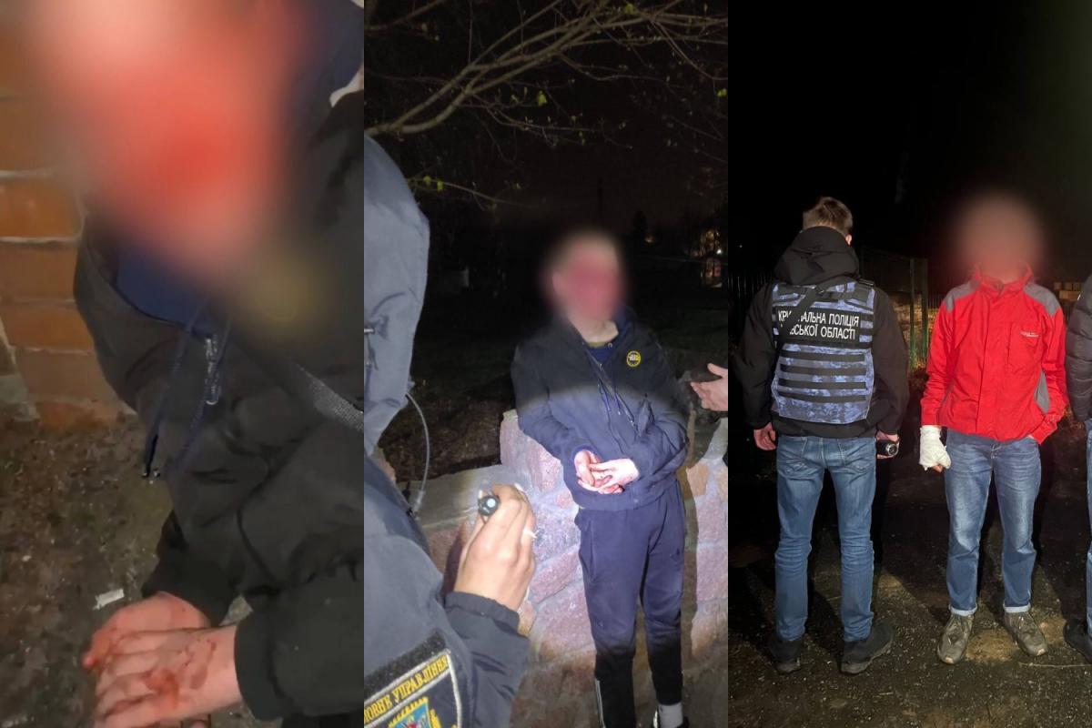 До сотрясения мозга: двое подростков в Киевской области совершили жестокое нападение на сверстника / фото t.me/andrii_nebytov До сотрясения мозга: двое подростков в Киевской области совершили жестокое нападение на сверстника / фото t.me/andrii_nebytov