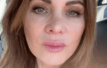 Колола ботокс 20 років: жінка показала, на що перетворилося її обличчя (відео)