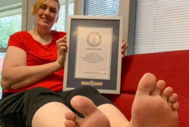 У мережі показали жінку з найбільшим у світі розміром ноги (фото)