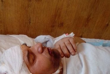 На Волині офіцер жорстоко побив пораненого військового: ДБР відкрило справу