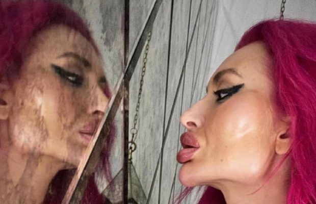 "Грудь скоро лопнет": украинка с самыми большими скулами похвасталась новыми операциями