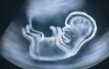 США впервые провели операцию на мозге еще не родившегося младенца