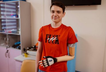 В Охматдиті підлітку з Херсонщини, який втратив руку через обстріл, встановили протез