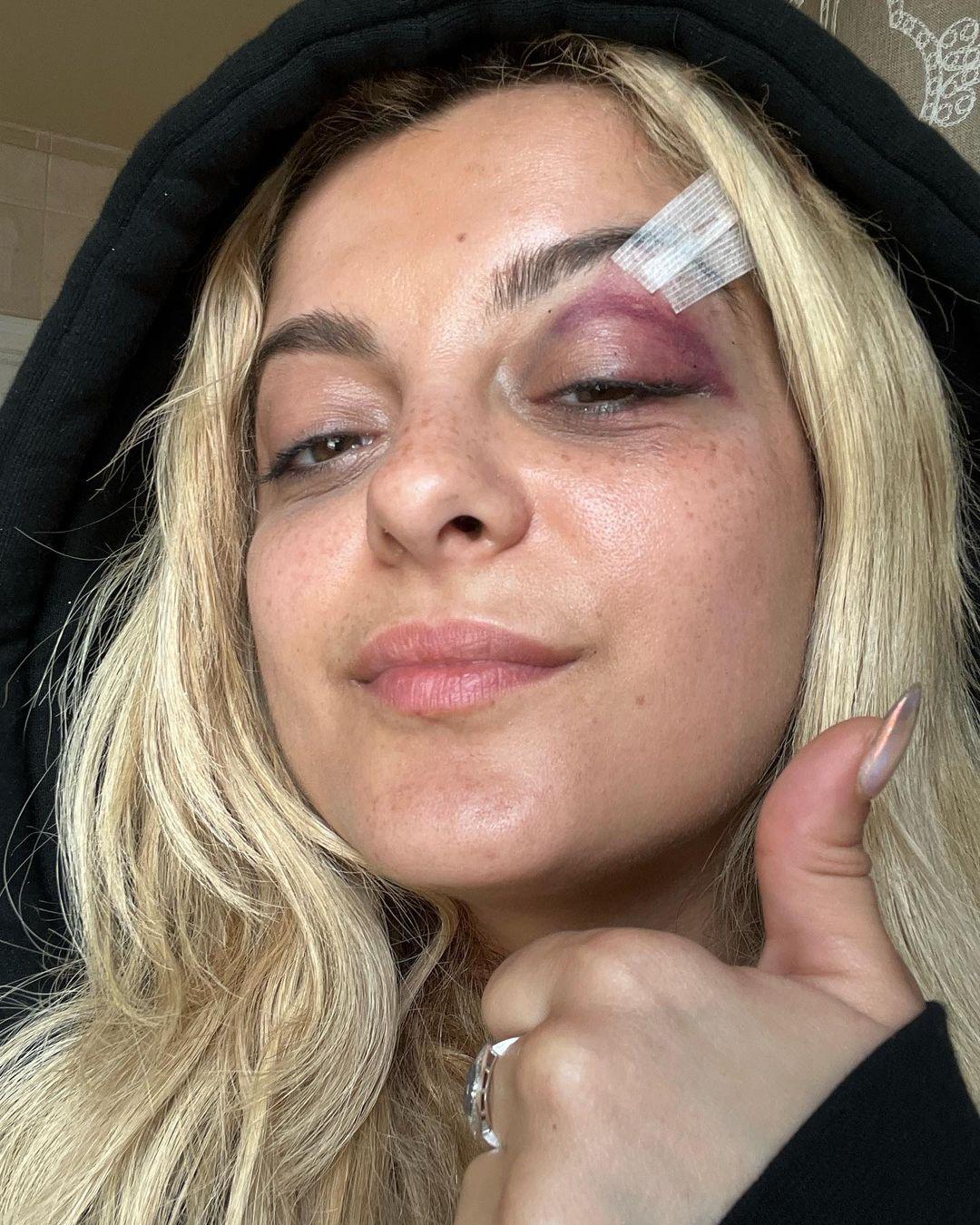 Bebe Rexha після походу до лікаря / скріншот Bebe Rexha після походу до лікаря / скріншот