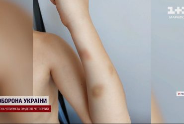 Побиття дитини дружиною прокурора - деталі скандалу