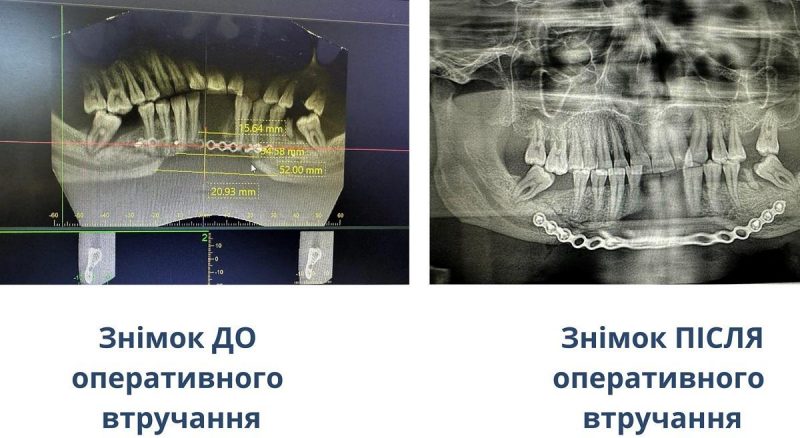 ОКНП"Черновицкая областная клиническая больница" ОКНП"Черновицкая областная клиническая больница"