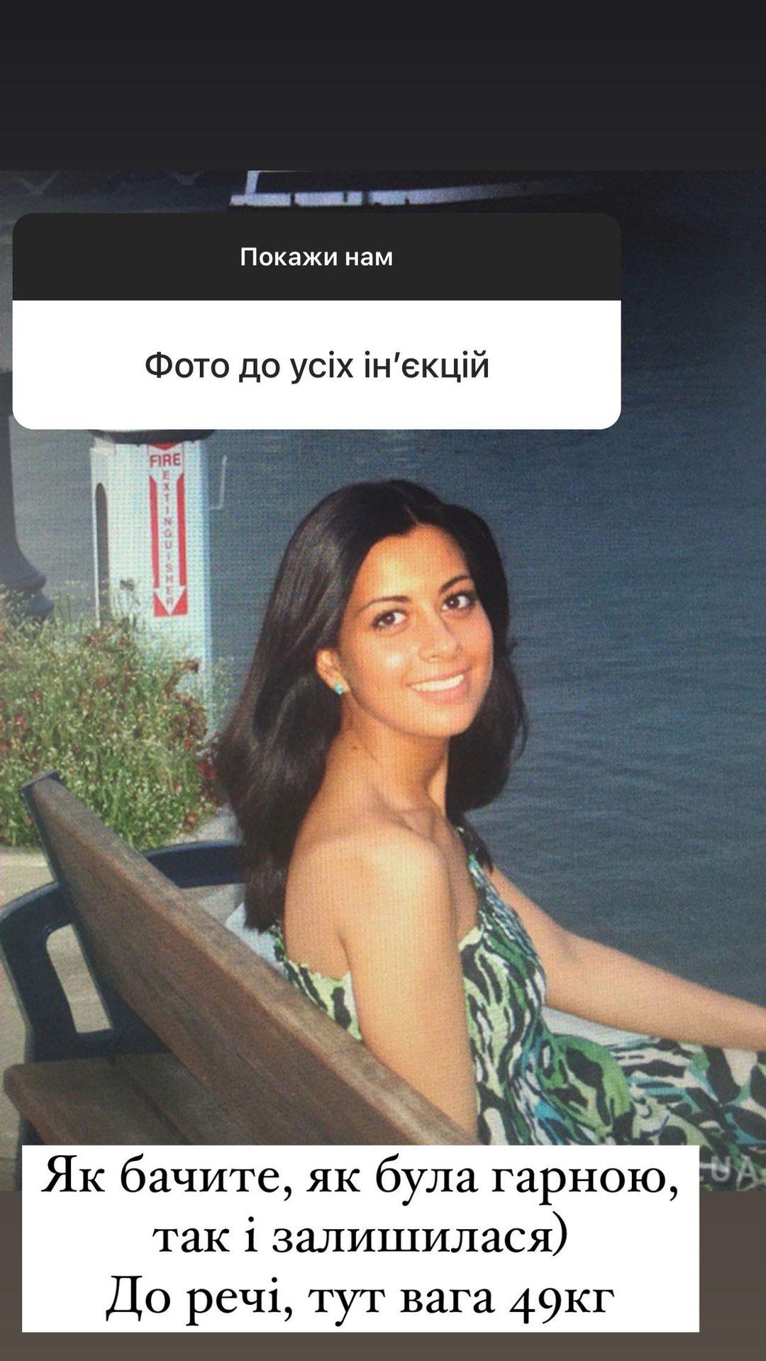 Рамина Эсхакзай показала, как выглядела до 'уколов красоты' Рамина Эсхакзай показала, как выглядела до 'уколов красоты'