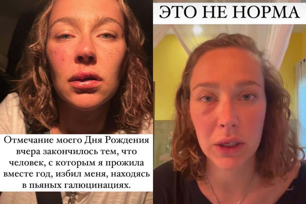 Россиянка заявила, что ее избил бойфренд-украинец / скриншот Россиянка заявила, что ее избил бойфренд-украинец / скриншот