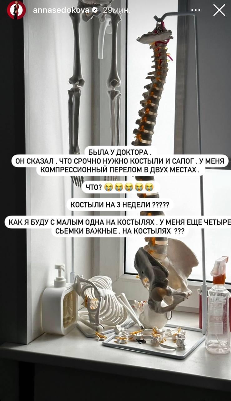 Сєдокова зламала ногу / скріншот Instagram Сєдокова зламала ногу / скріншот Instagram