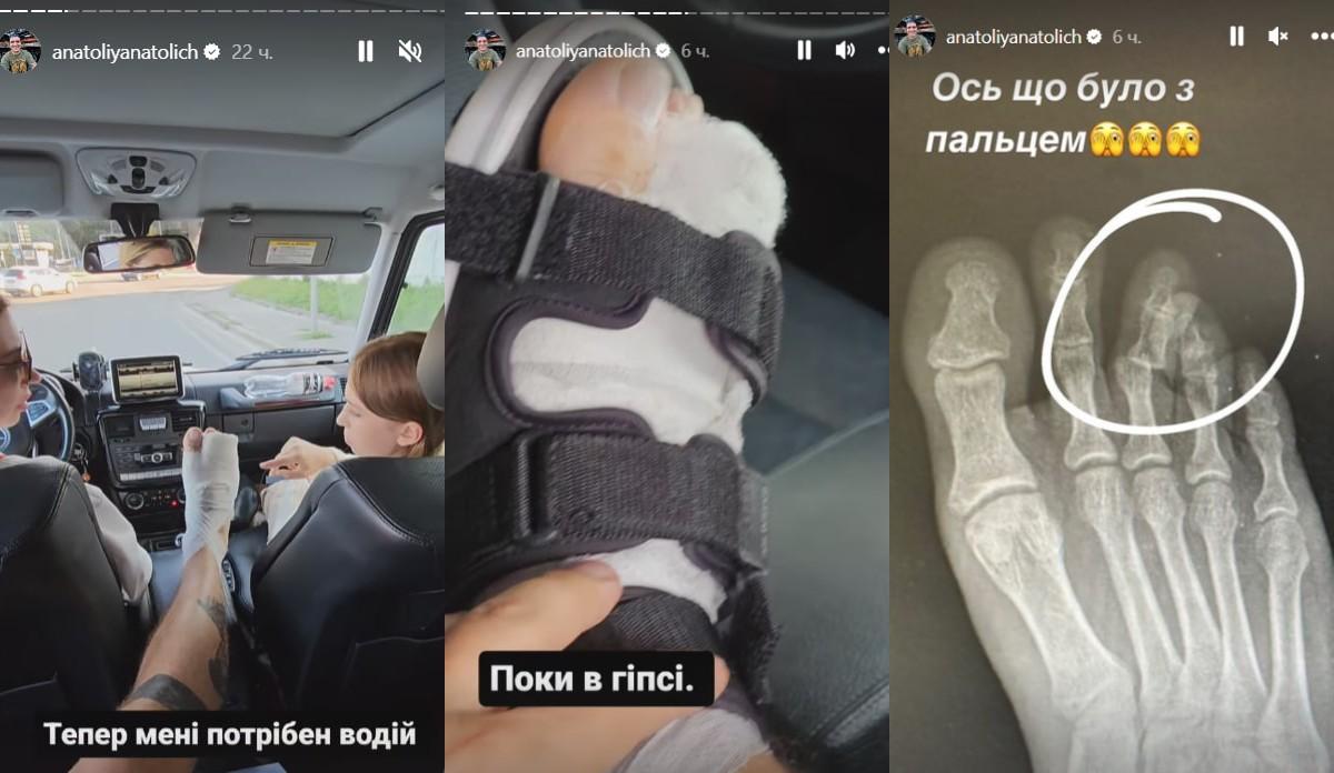 Анатолий Анатолич серьезно травмировался / скриншоты Анатолий Анатолич серьезно травмировался / скриншоты