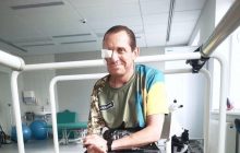 Подолав 68 операцій: хірурги Львова створили "титанове" обличчя бійцю ЗСУ (фото)