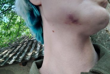 В Ужгороді нетверезий майор ТЦК побив жінку на вулиці на очах чоловіка-військового (фото)