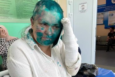 У Чечні жорстоко побили журналістку, якій публічно погрожував Кадиров (відео)