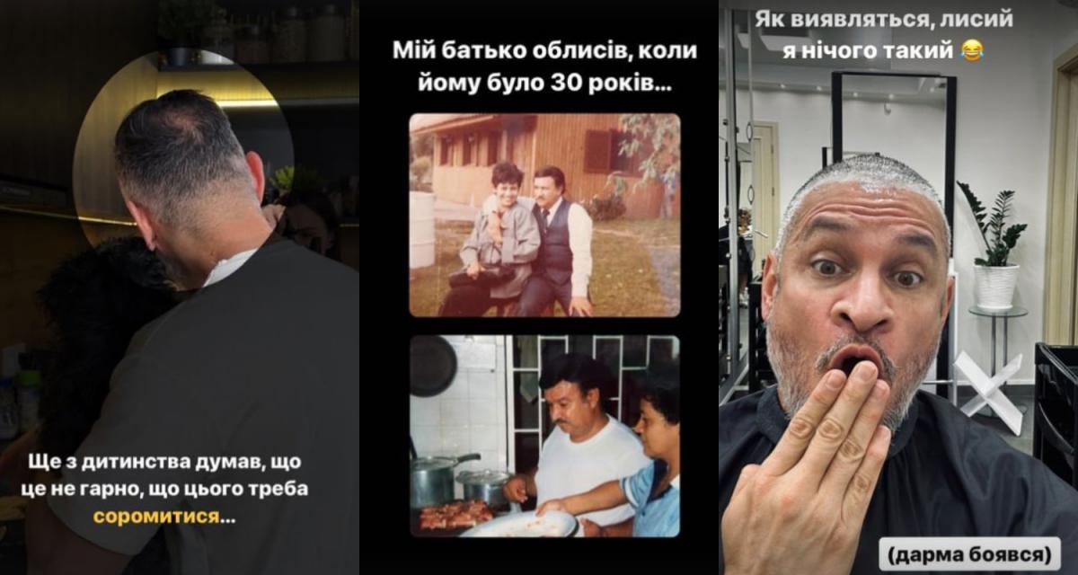 Эктор Хименес-Браво перенесет операцию, ради которой ему пришлось побрить голову / скриншоты Эктор Хименес-Браво перенесет операцию, ради которой ему пришлось побрить голову / скриншоты