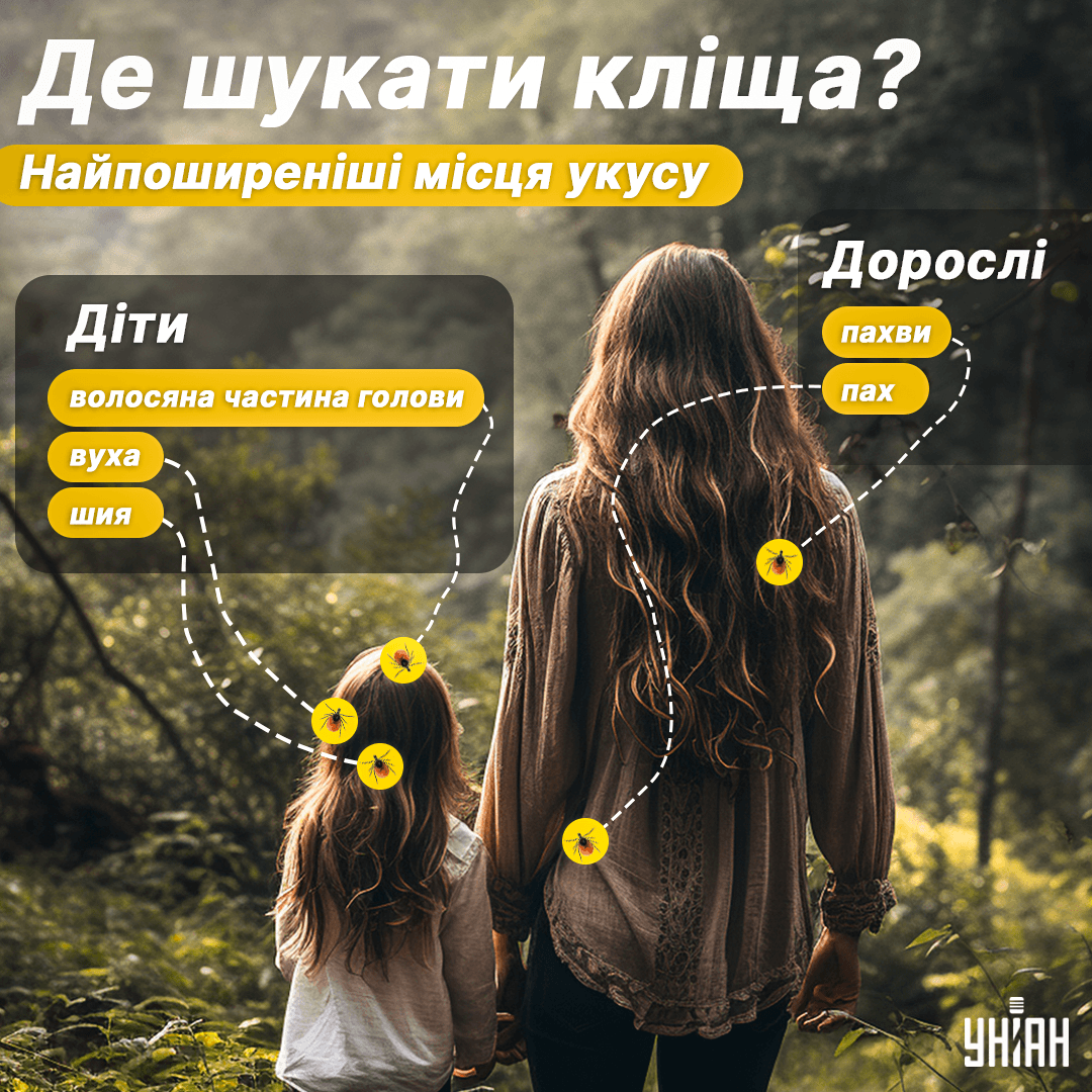 Куди кусають кліщі / інфографіка УНІАН Куди кусають кліщі / інфографіка УНІАН
